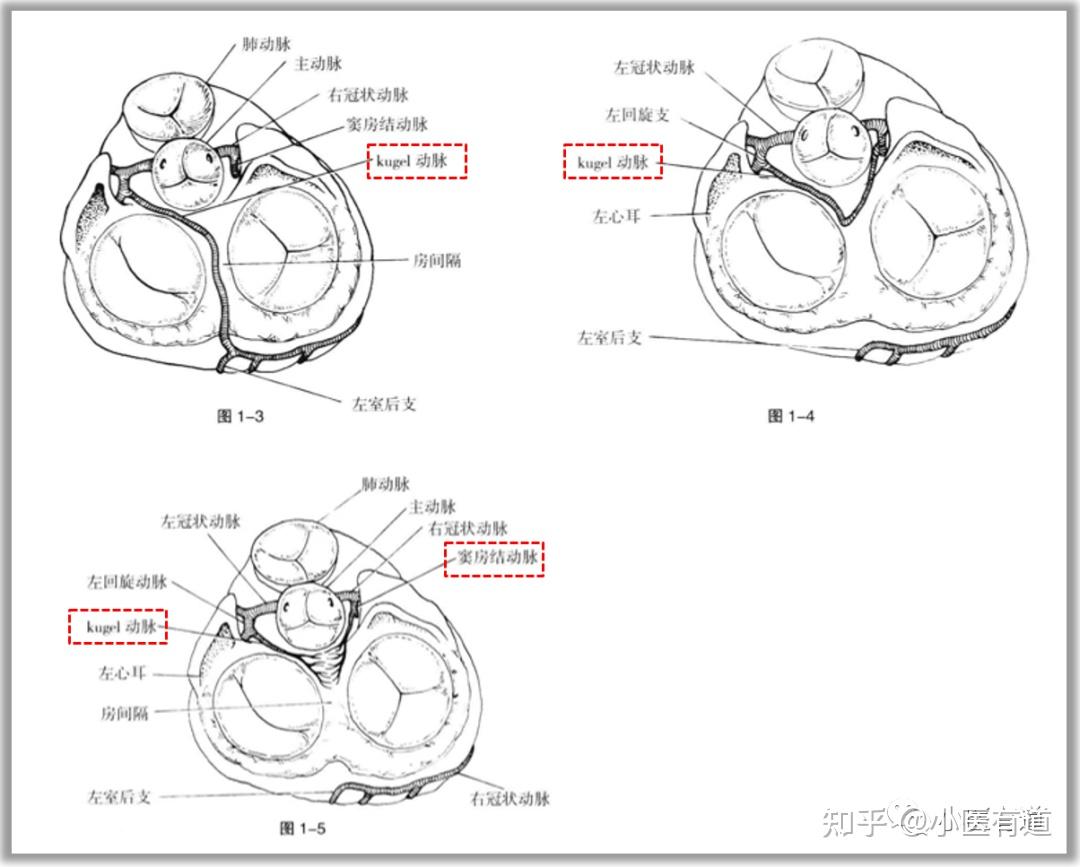 回旋支om图片