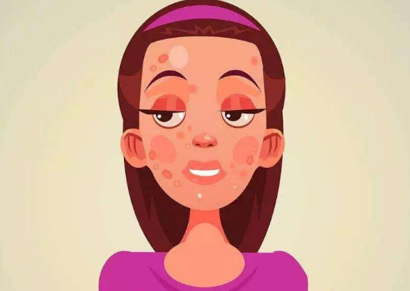 脸上出油太多怎么回事如何解决