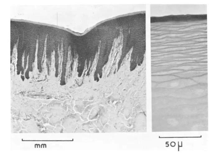 为什么动物进化不出皮甲？