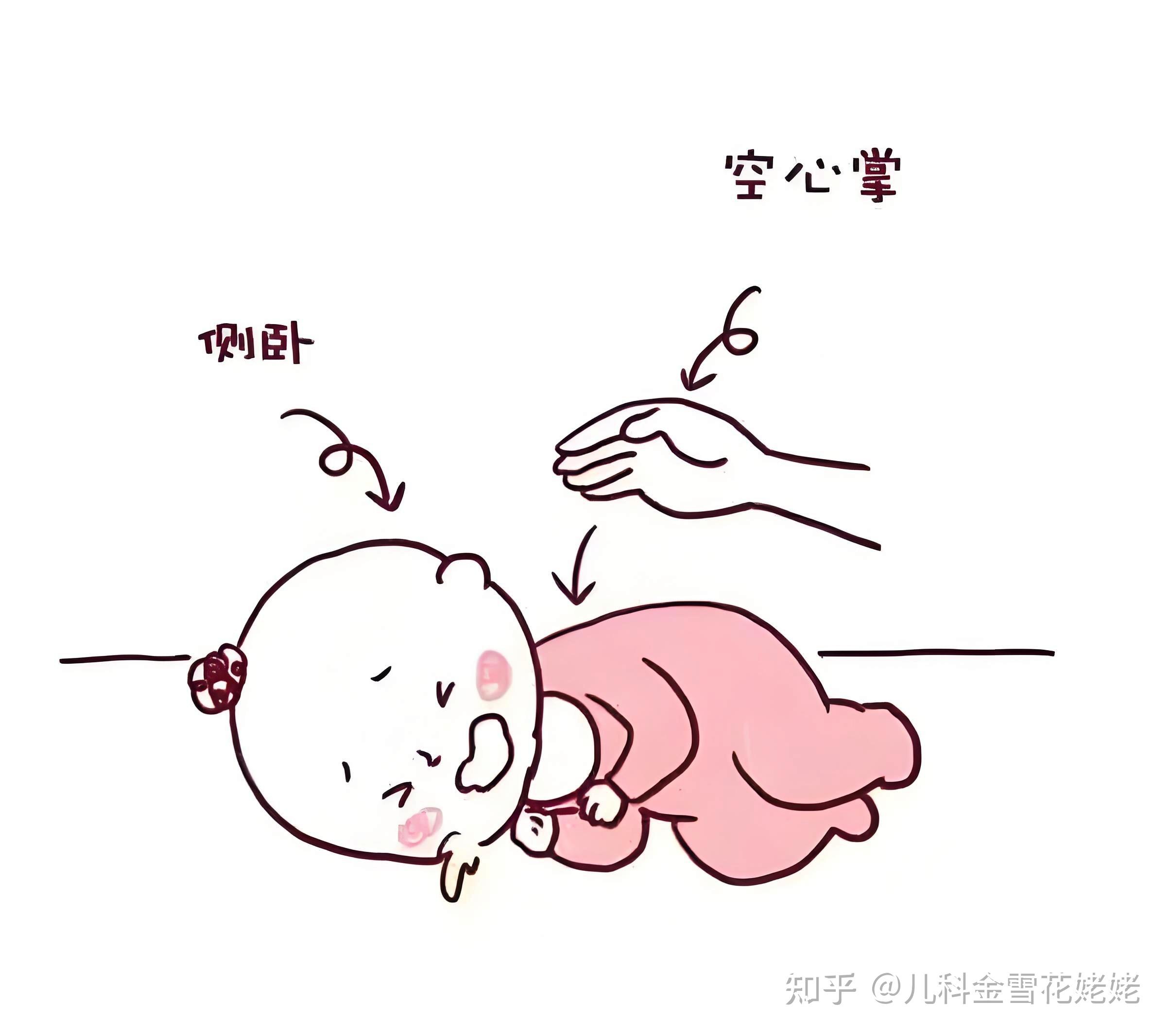 婴儿呛奶,第一时间应该怎么做?