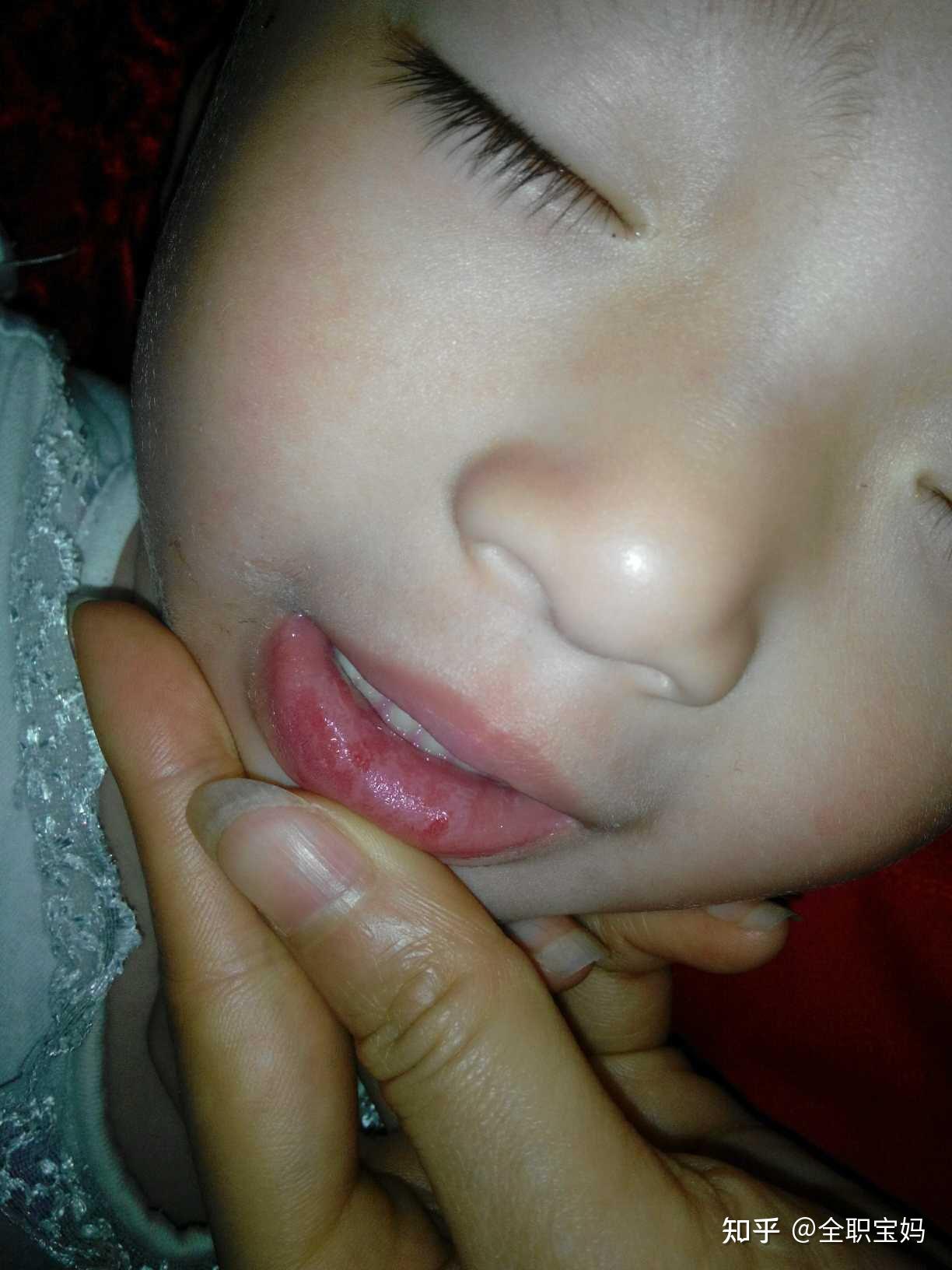 宝宝嘴唇总是很干怎么办?