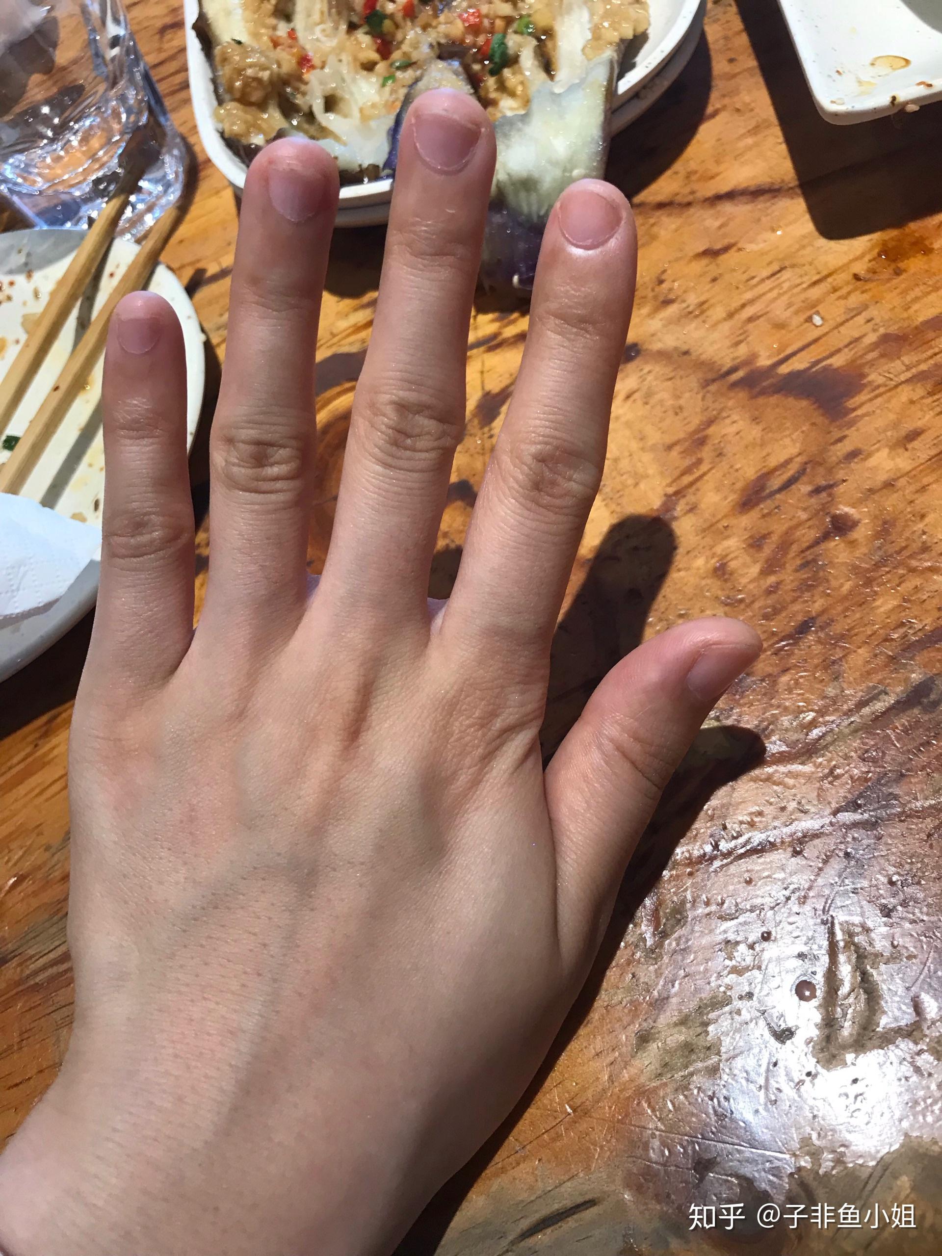 女生的手丑成这样怎么办