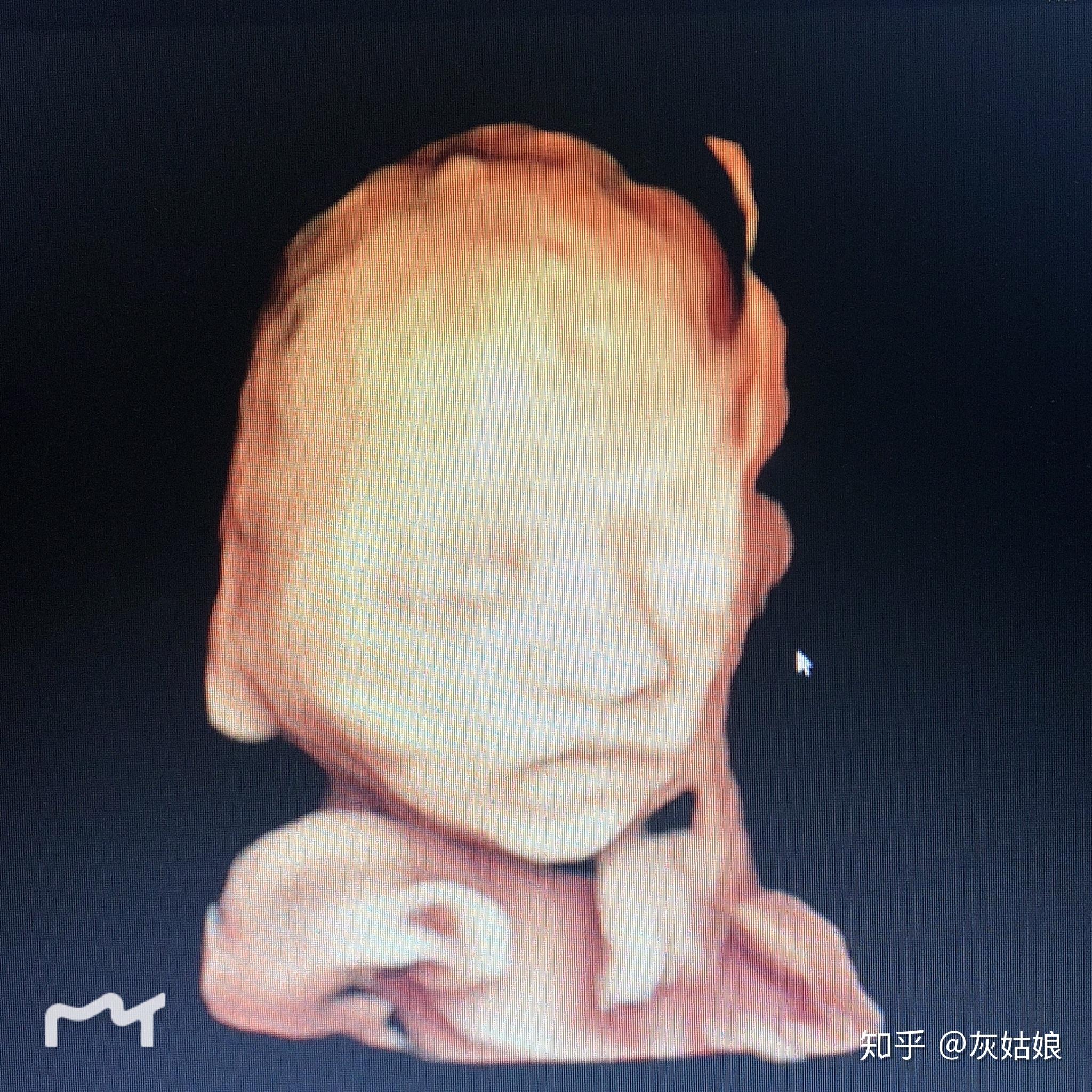 胎儿四维彩超真实图片