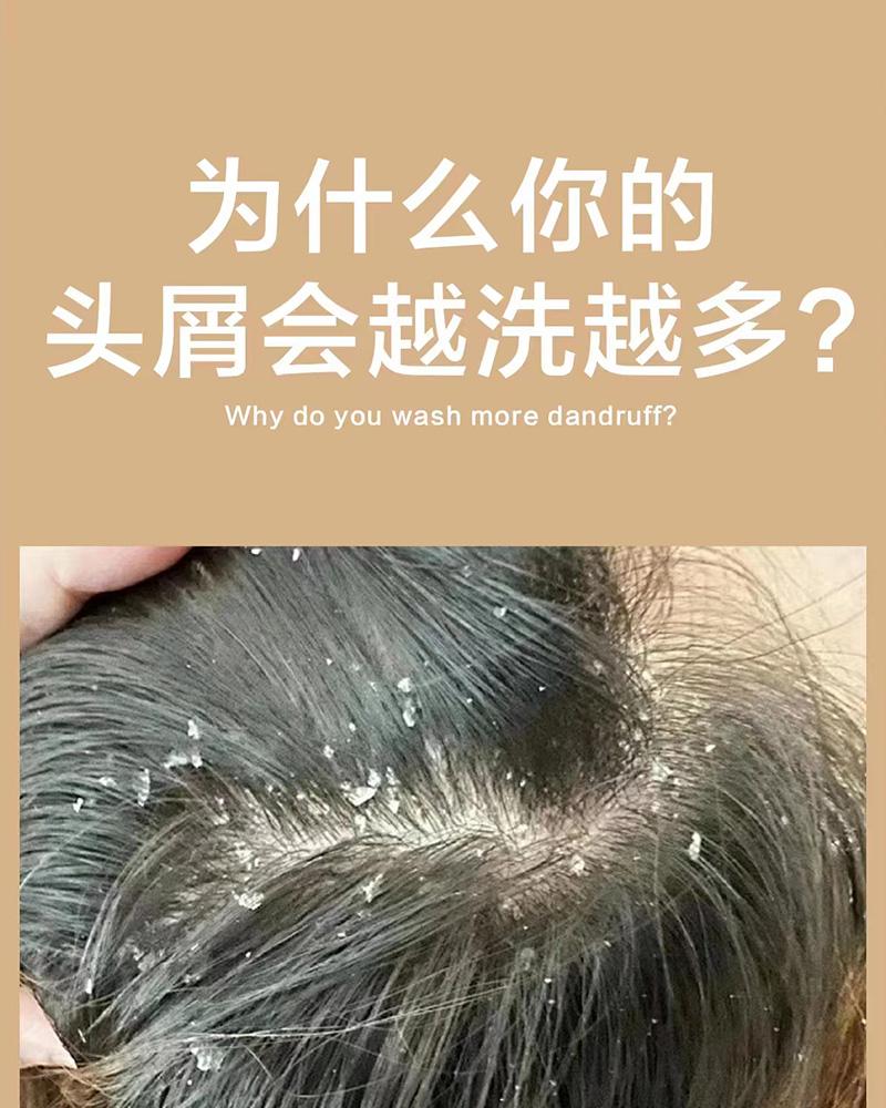 男士去屑洗发水哪个牌子效果最好?能真的去头皮屑的洗发水推荐 - 知乎