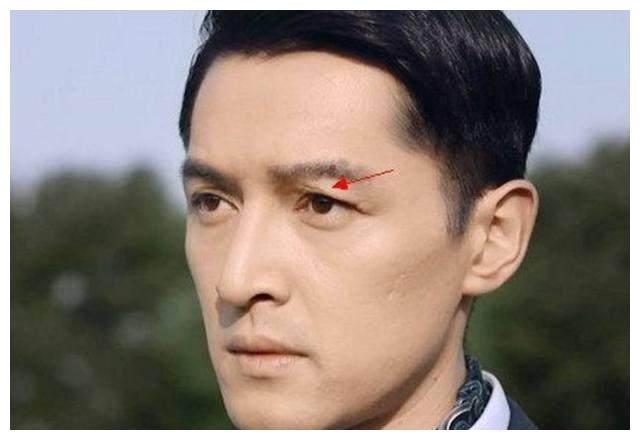 揭秘：脸上的疤痕预示着什么？ - 知乎