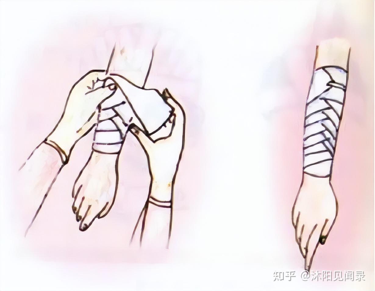 绷带如何包扎 - 知乎