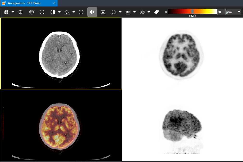医学影像专业必备的DICOM Viewer软件 - 知乎