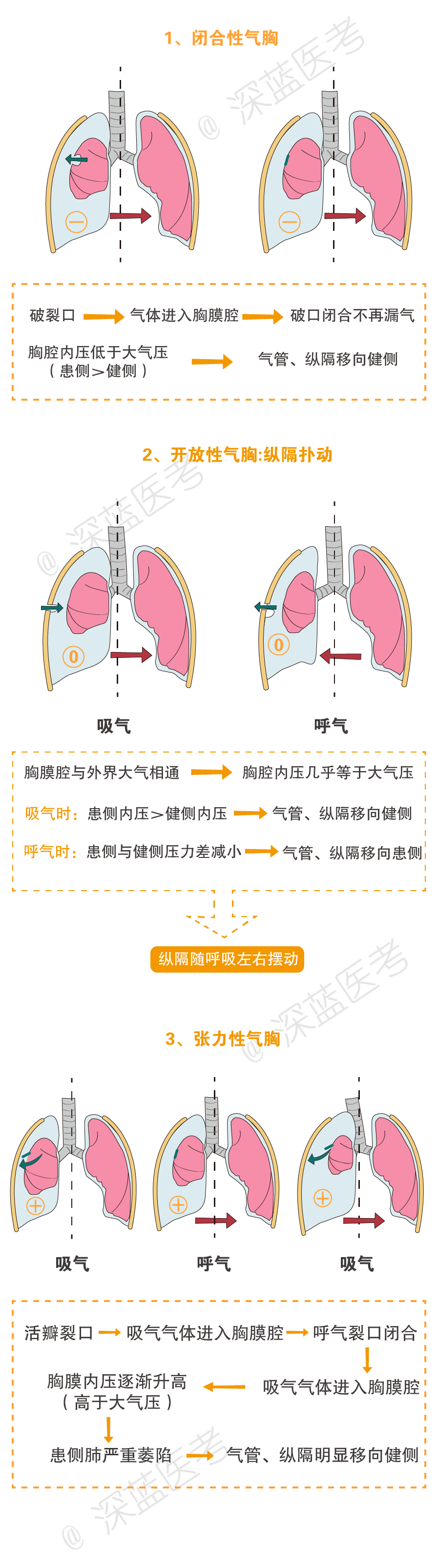 三种气胸的图片图片