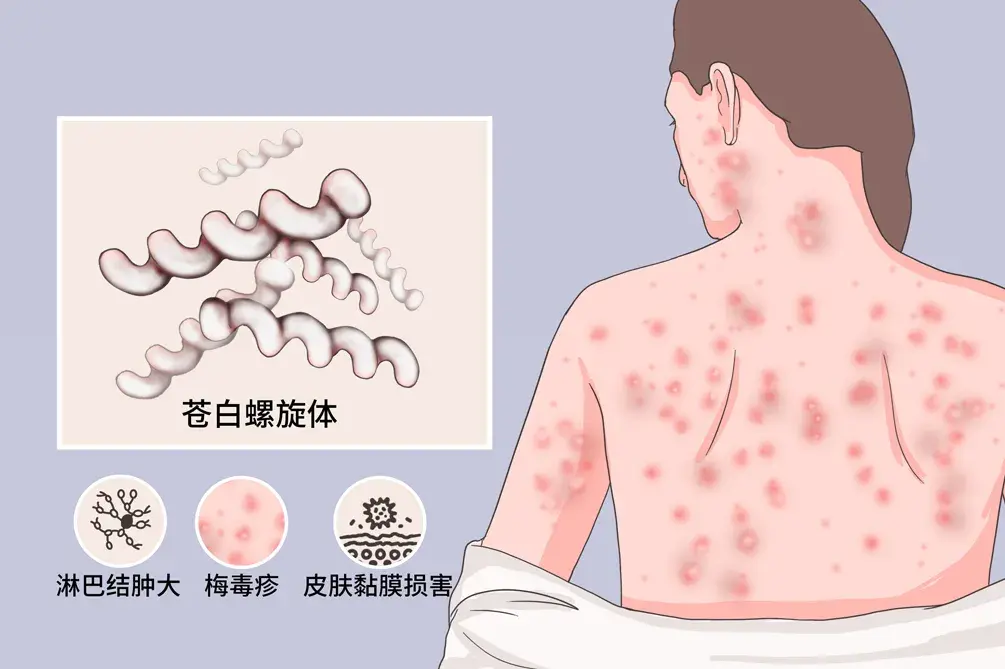 发生性关系前让男朋友去医院进行性病筛查合适吗