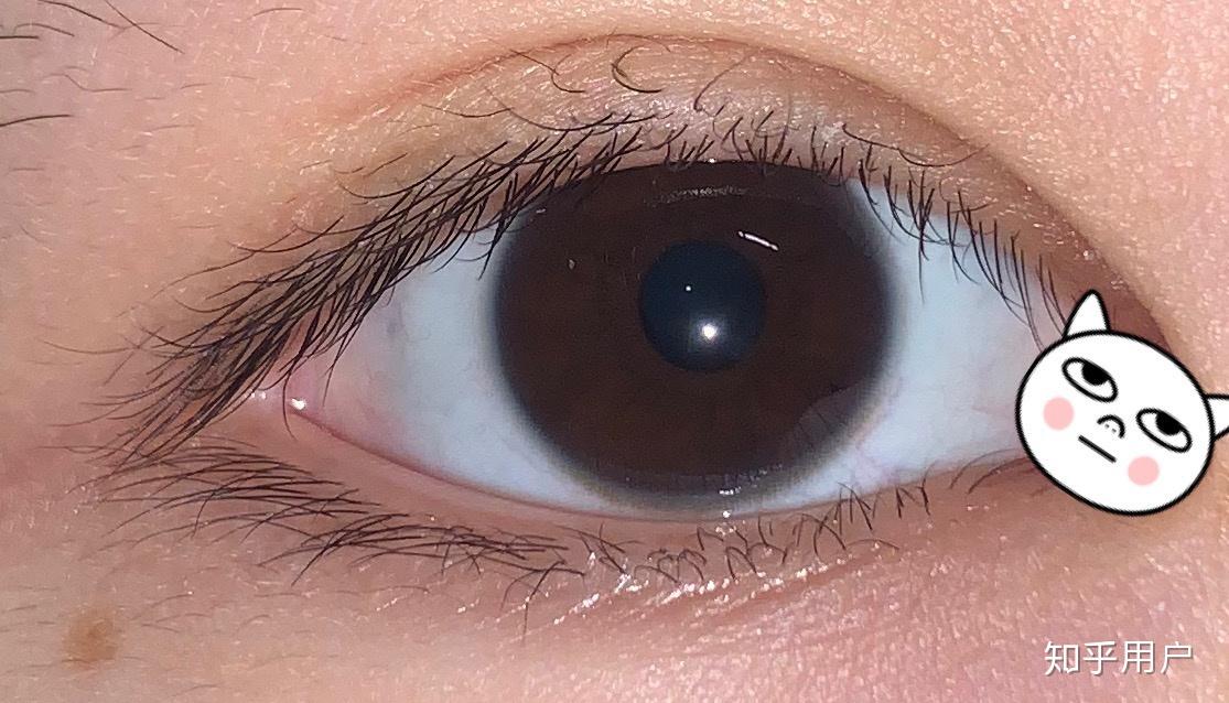 什么是双睫症身边有这样的朋友吗