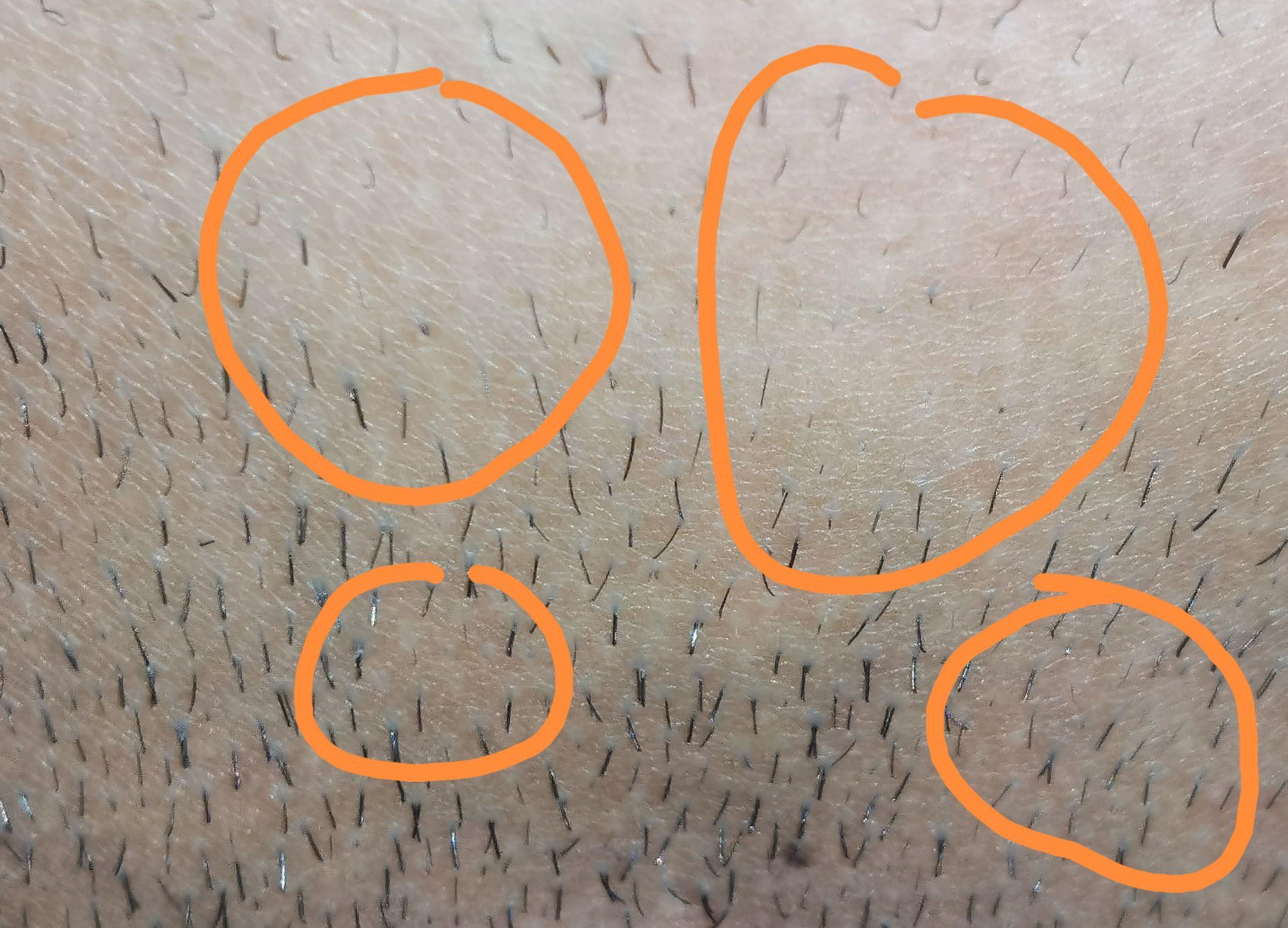 脱阴毛的男生是什么感觉? - 知乎