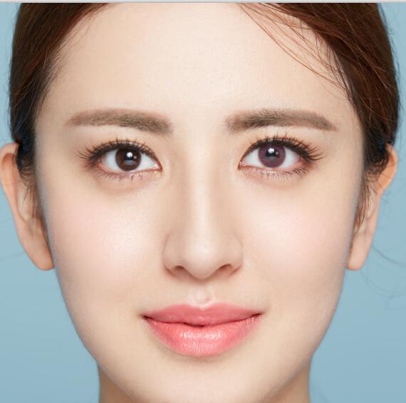 美瞳变形了怎么办,美瞳变形了怎么办小妙招