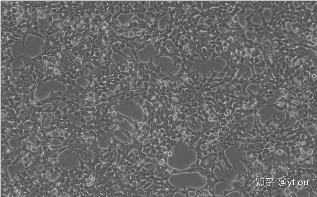 293t细胞总是漂起来究竟是什么原因呢