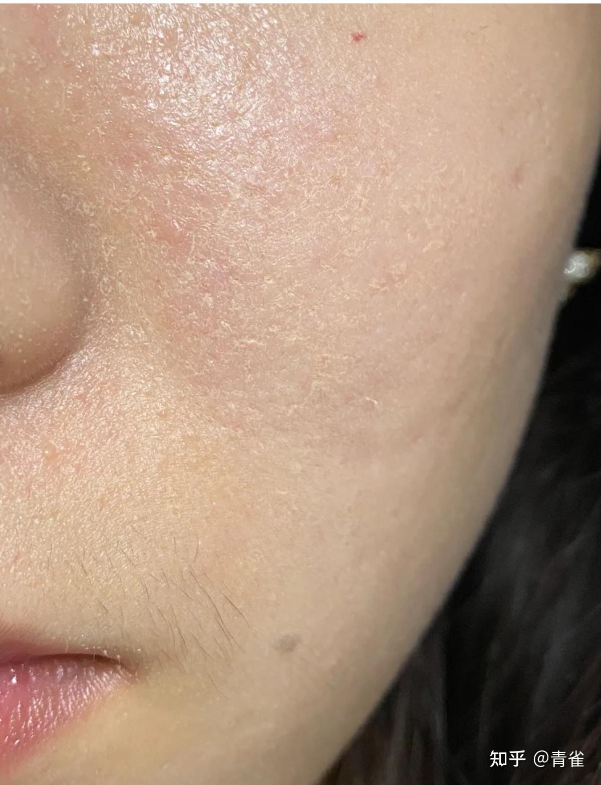 一直卡粉是脸的锅还是粉的锅