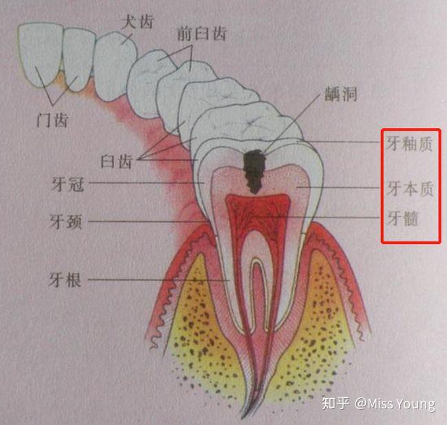 牙龈红线示意图图片