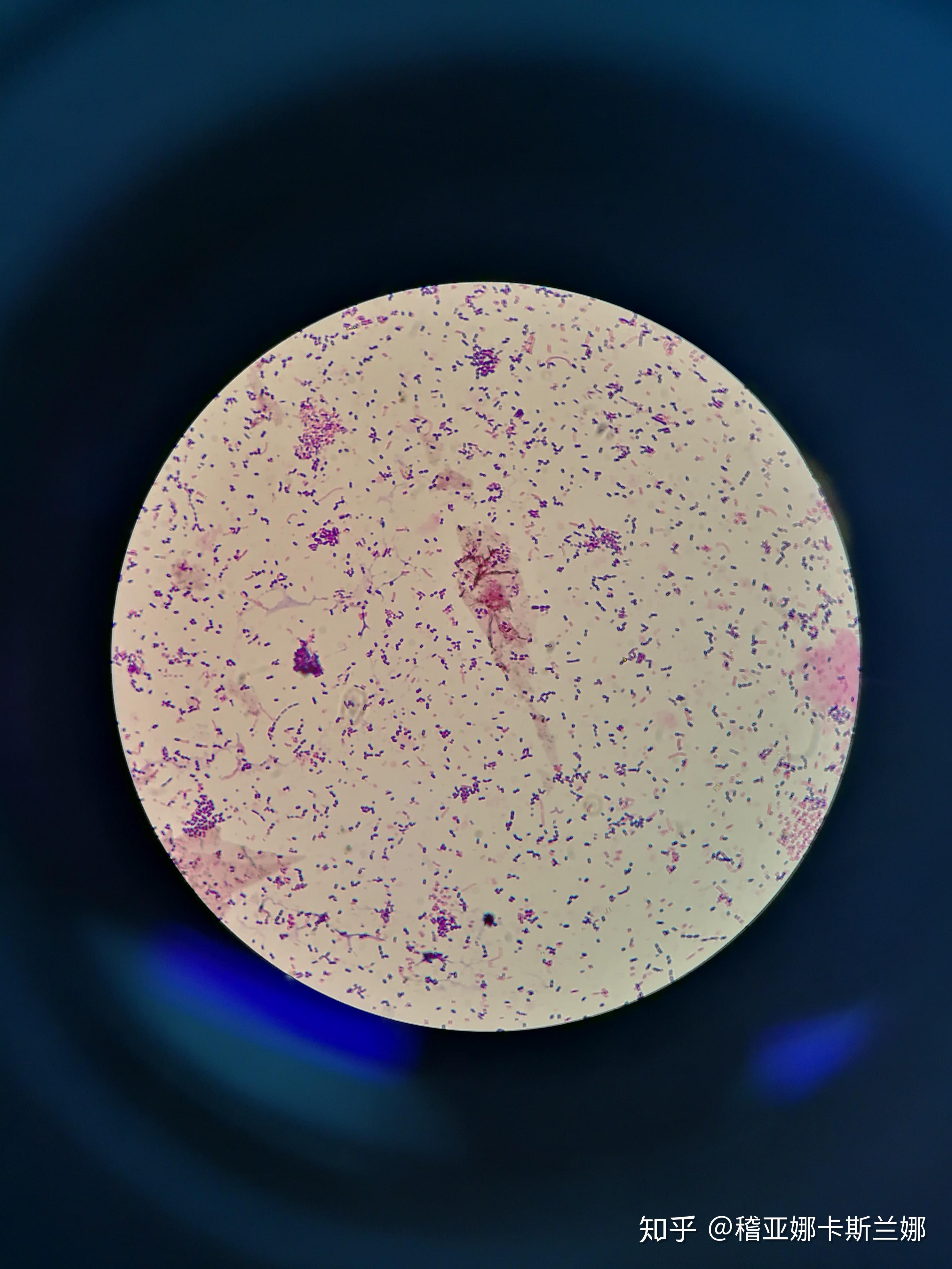 口腔里细菌那么多,那接吻的时候细菌会通过唾液转移到另一个人的口腔