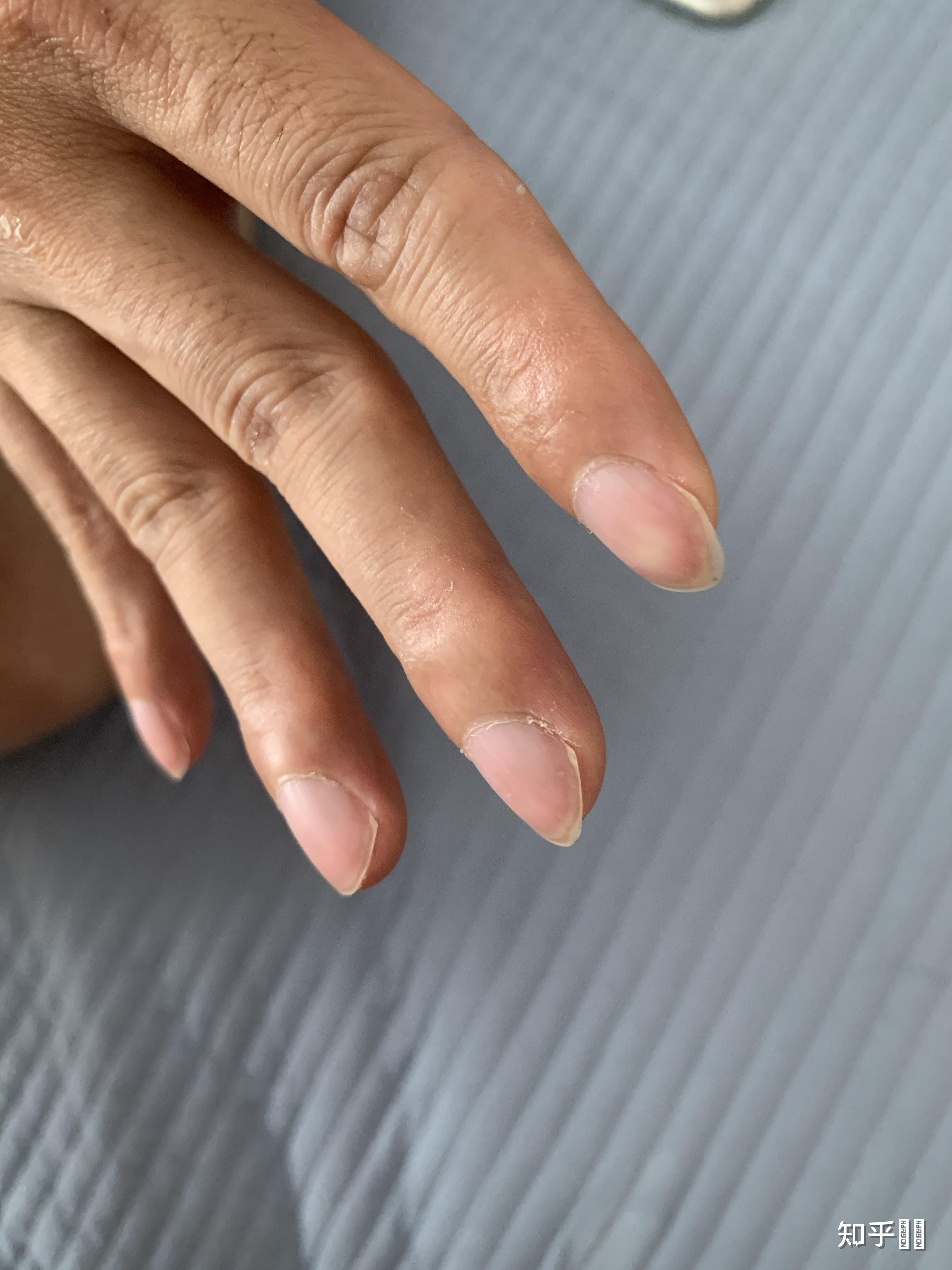 男朋友手指长这样是不是有问题? - 知乎