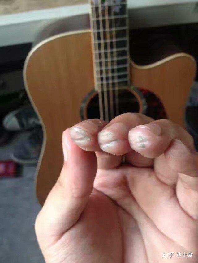 练吉他的时候左手按弦手指尖疼而且爆皮了怎么办? - 知乎