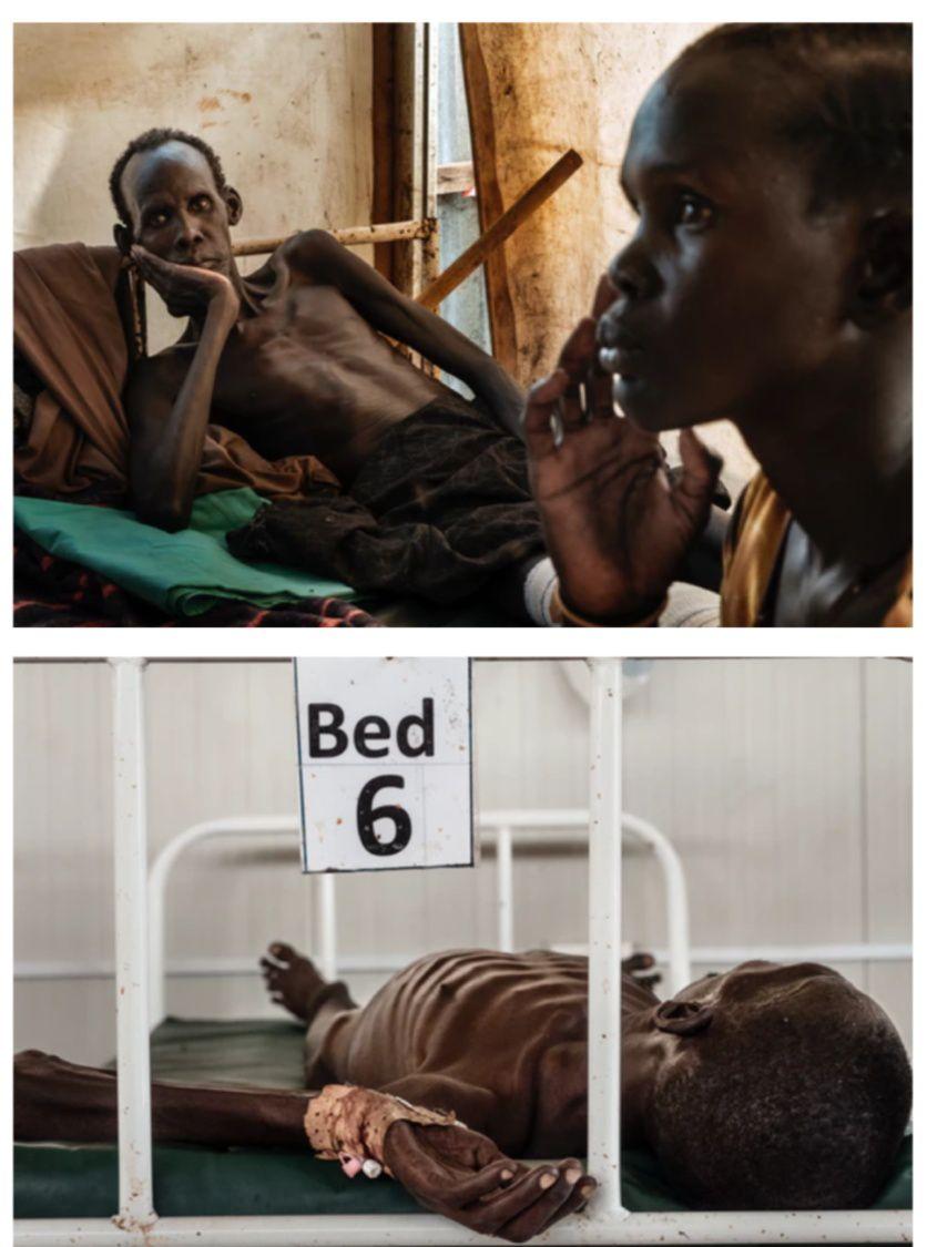 非洲现在还存在饥饿问题吗? - 知乎