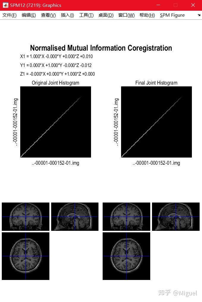 基于 SPM 对 FMRI 进行数据预处理 - 知乎