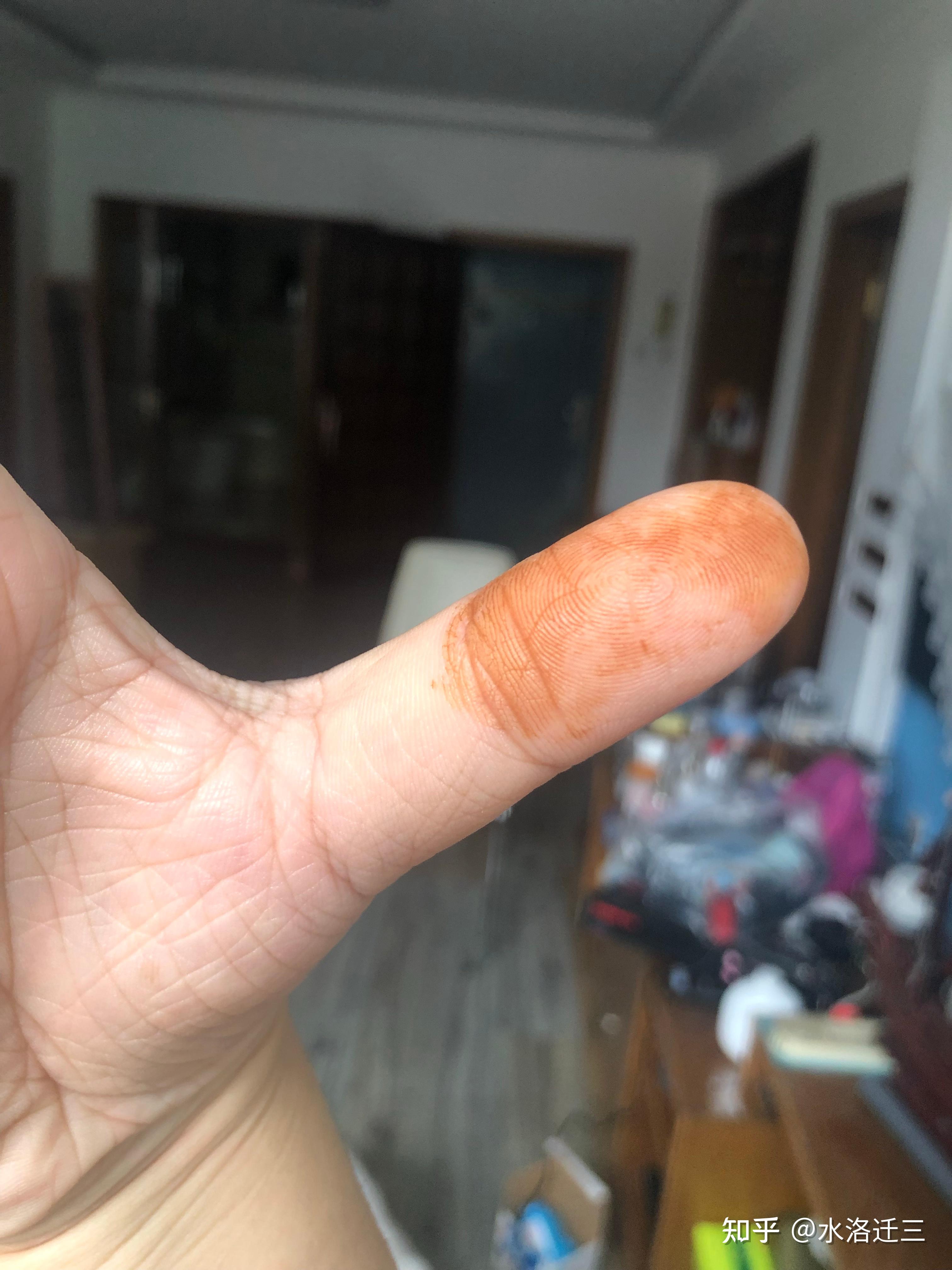 一觉醒来手上有铁锈一般的黄色块洗不掉? - 知乎
