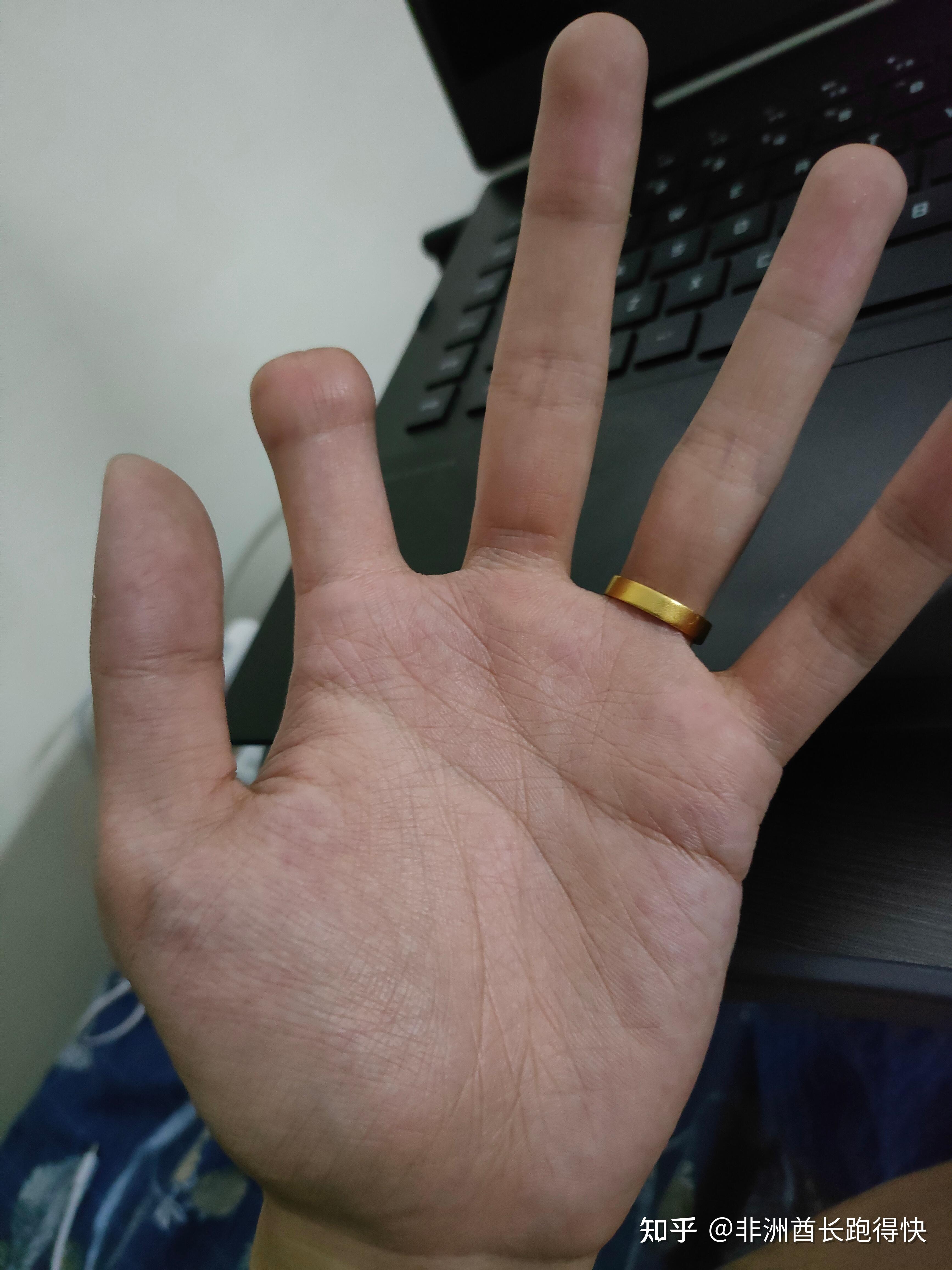 如果你身体上某一个部位有残疾但又不容易暴露出来比如手指残疾啊什么