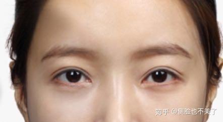 眉弓低平有什么丰眉弓的推荐吗