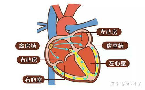 心臟傳導系統的竇房結重度纖維化是否會導致死亡?