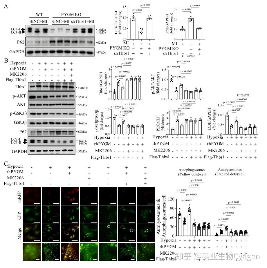 Circulation（IF=38.6）丨PYGM通过促进糖原分解与自噬流保护心肌梗死 - 知乎