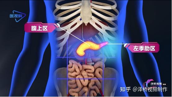 胰的位置及吃什么对胰腺好? - 知乎