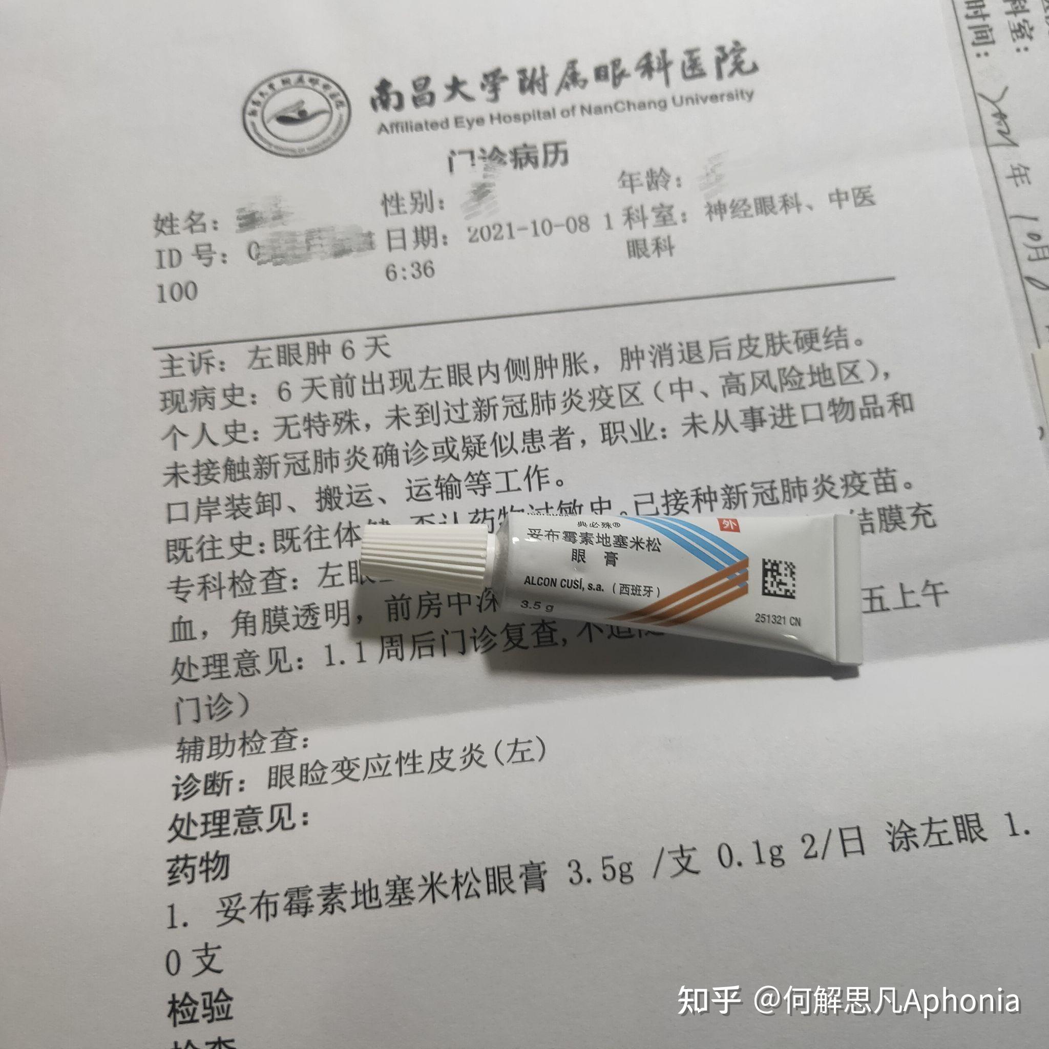 最近眼睛周围皮肤得了神经性皮炎奇痒怎么破