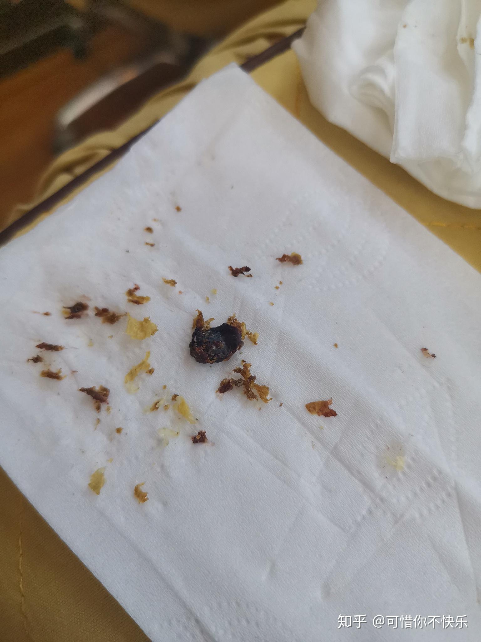 耳屎最大能有多大