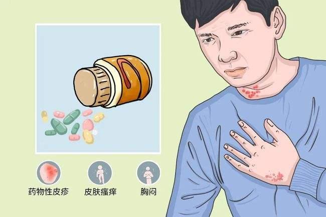 有药物过敏史会影响招飞体检合格吗? - 知乎
