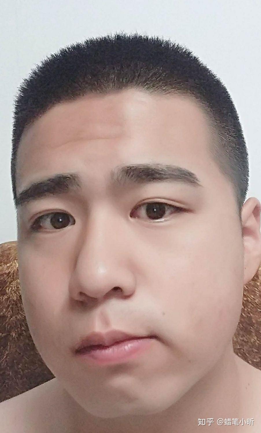 有没有内双到了一定年龄就变外双的事例? - 知乎