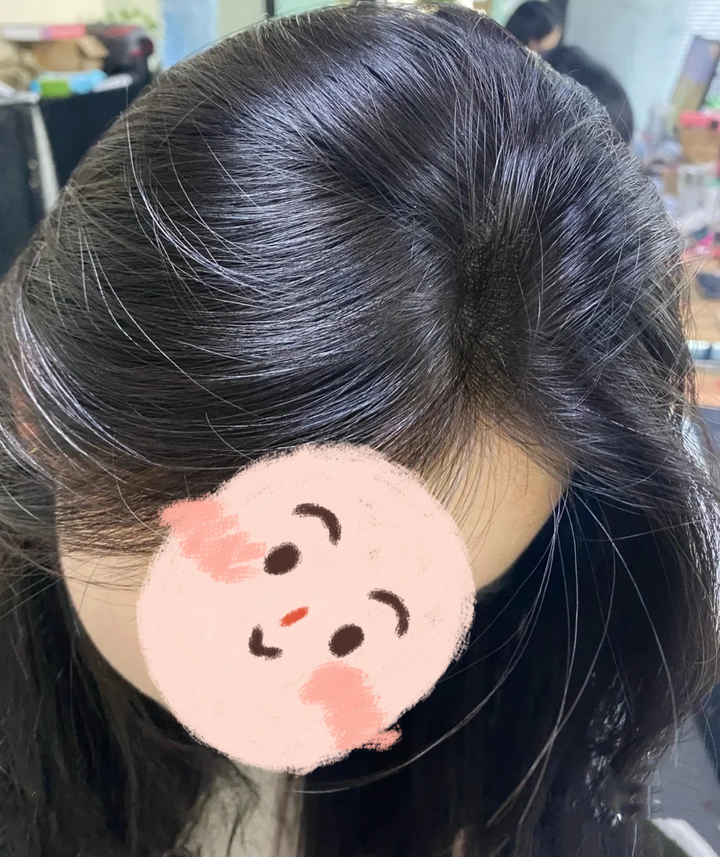 从15岁就有的少白头,真的还有办法能转黑吗? - 知乎