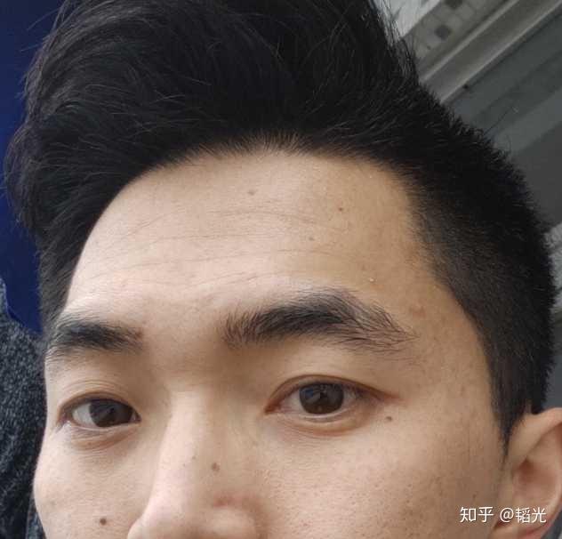 有没有人可以指点一下呀三颗痣连成一条线是怎么样阿