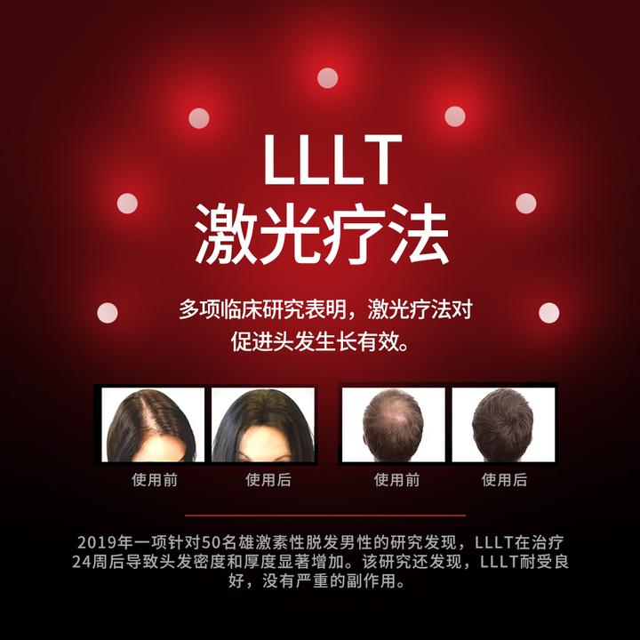 秋天掉发多正常吗?怎么才能稳住发量? - 知乎