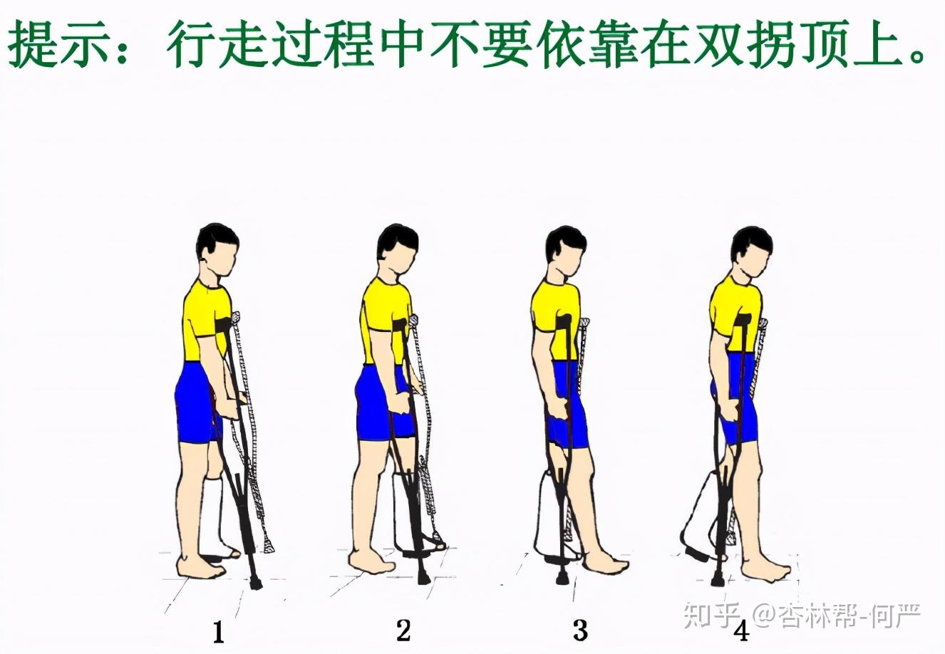 单腿残疾如何正确使用单拐? - 知乎