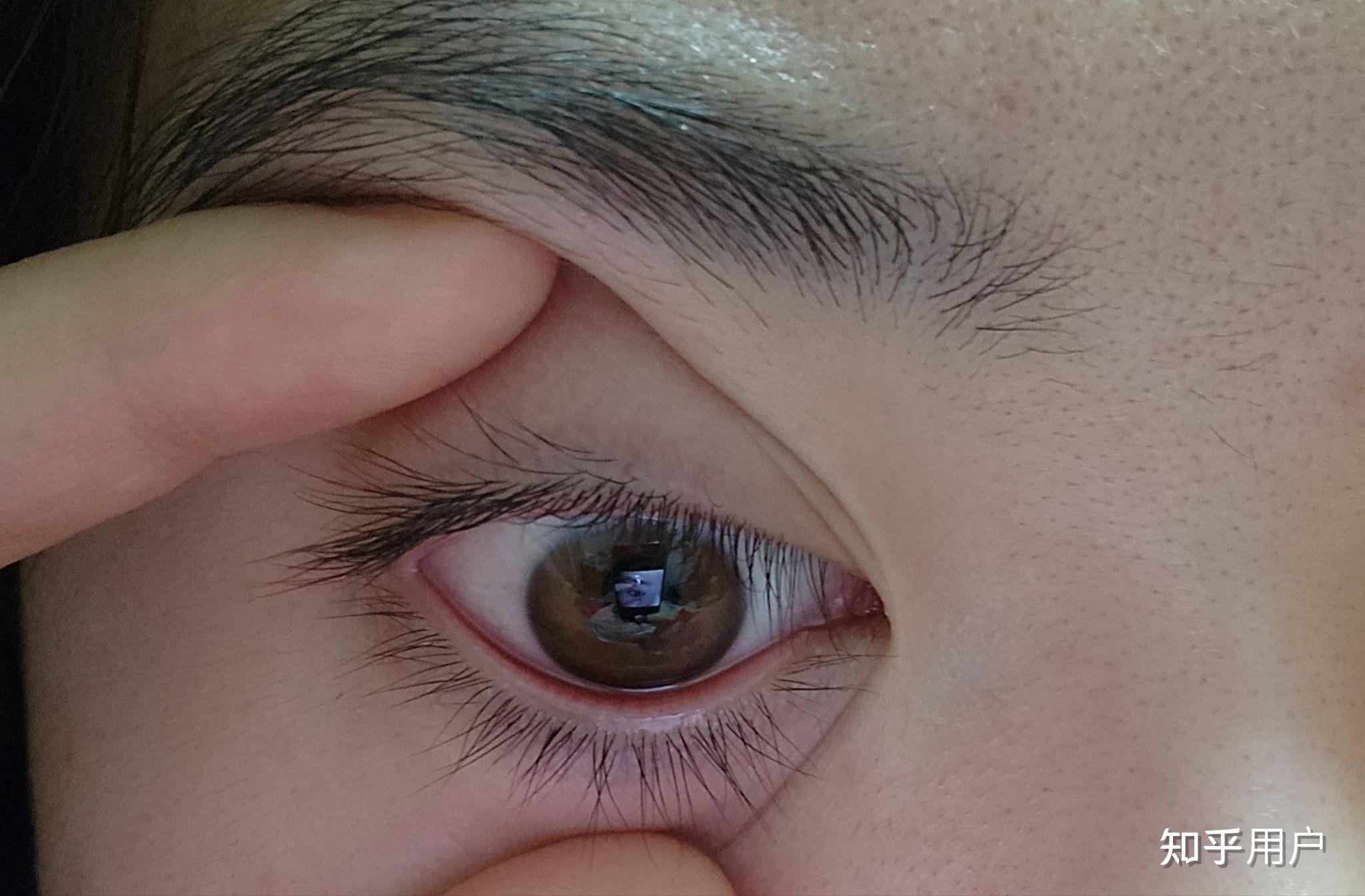 双层睫毛长什么样子?