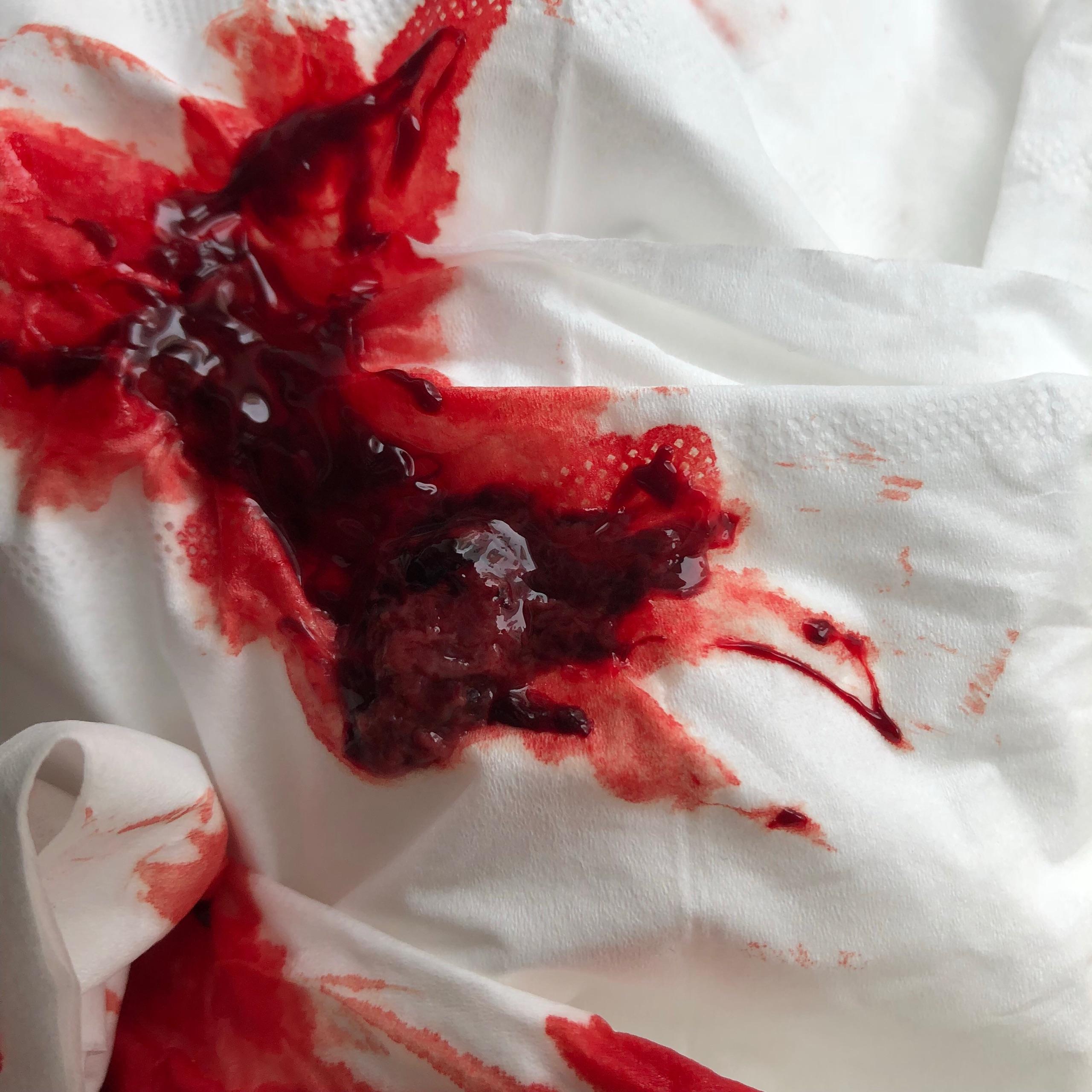 谁有亲身的药物流产的经历