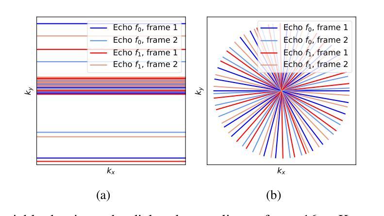 无监督/半监督/对比学习