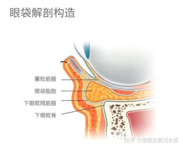 什么因素会导致眼袋加重?