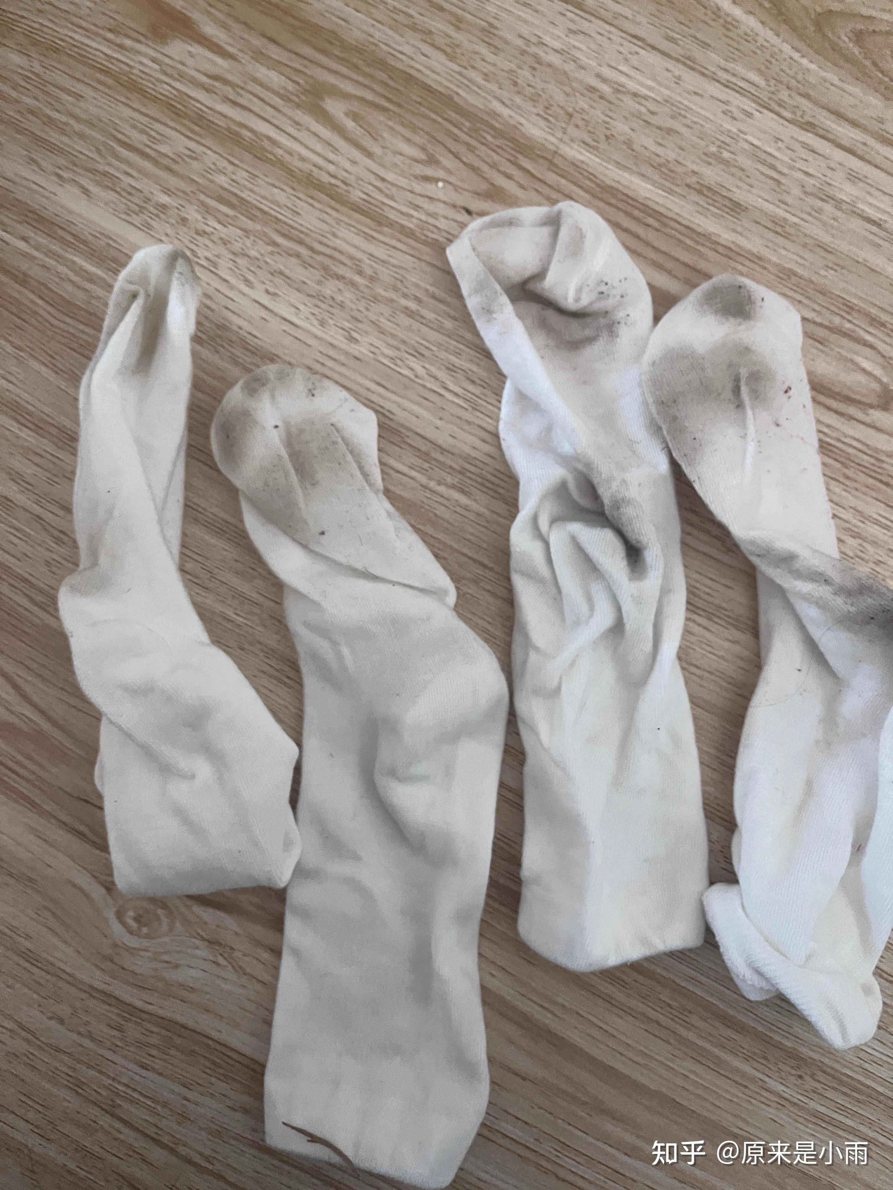 脚臭怎么办我是穿拖鞋都会有脚臭