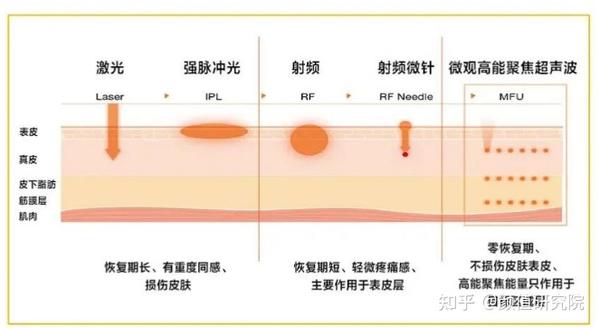 超声刀划线图讲解图片