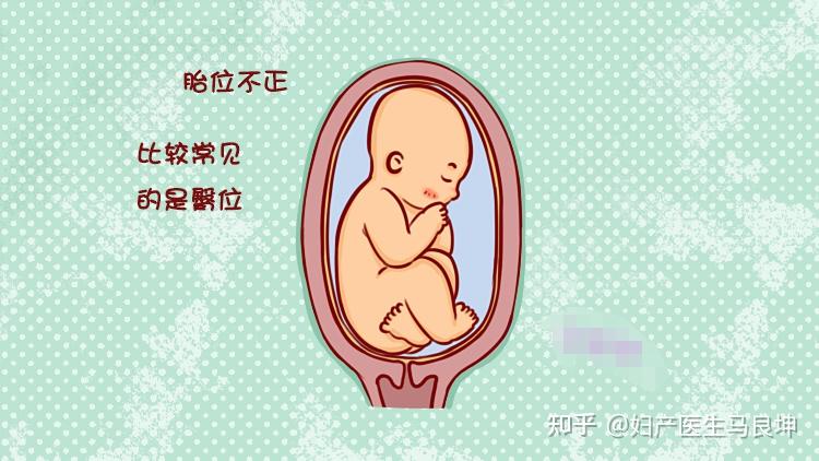 到了这个孕周,胎儿的“胎位”基本固定,以后再等着纠正就难了! - 知乎