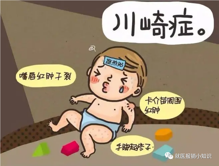什么是川崎病?有传染性吗? - 知乎