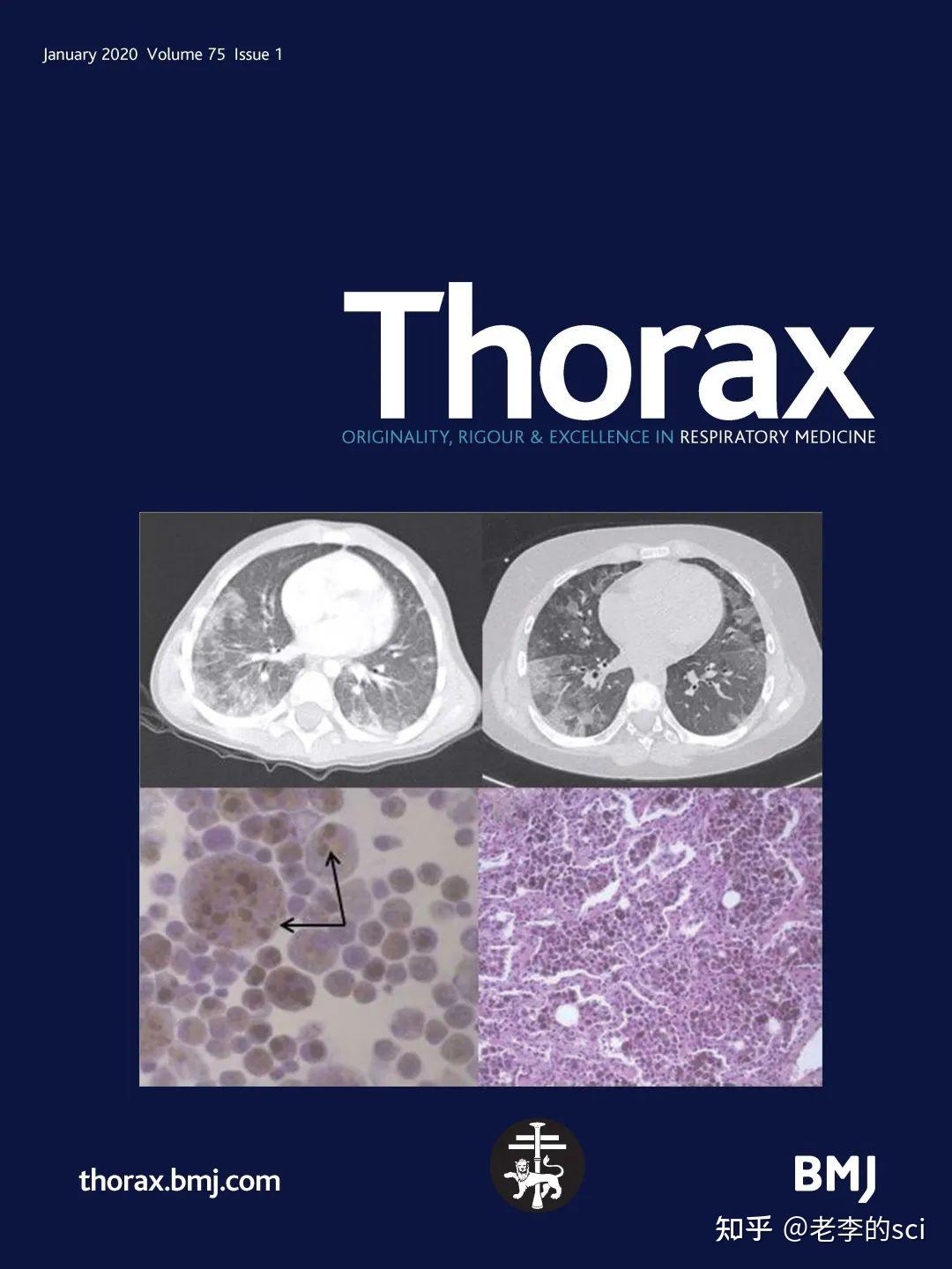 bulletin of the American Physical Society 上刊登算发表吗？ 知乎