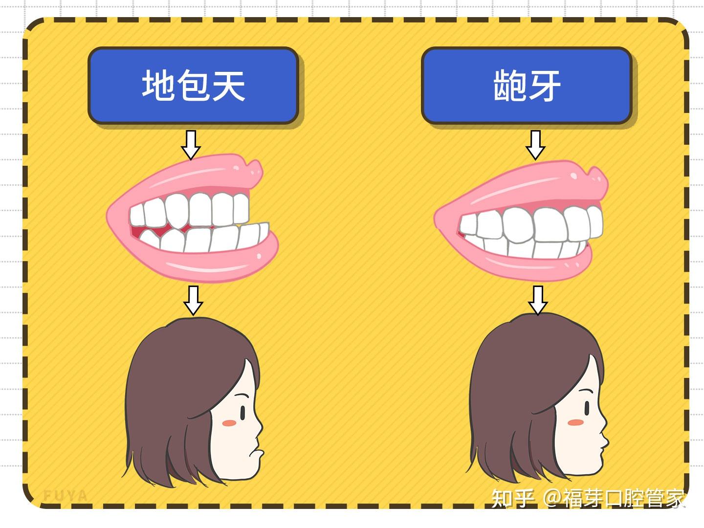 牙列不齐可是很影响颜值的! - 知乎