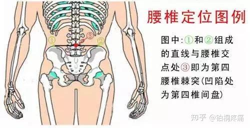 腰椎间盘突出急性发作期腿疼如何快速恢复