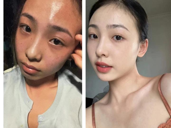 军训被晒黑了,有简单有效的方法美白吗? - 知乎